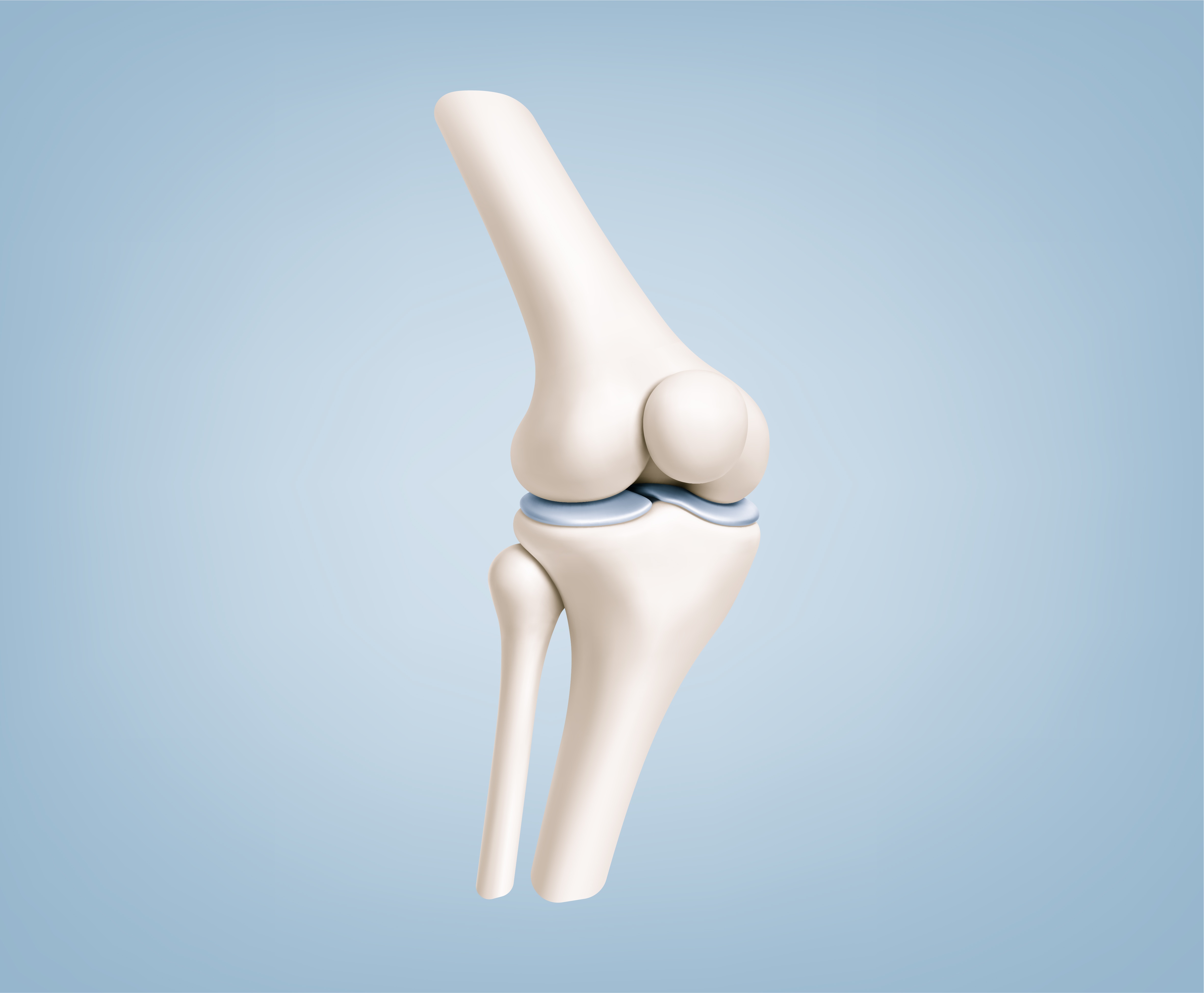 A computer-generated depiction of a knee joint against a light blue background. Total and partial knee replacement are surgical interventions to support pain relief.