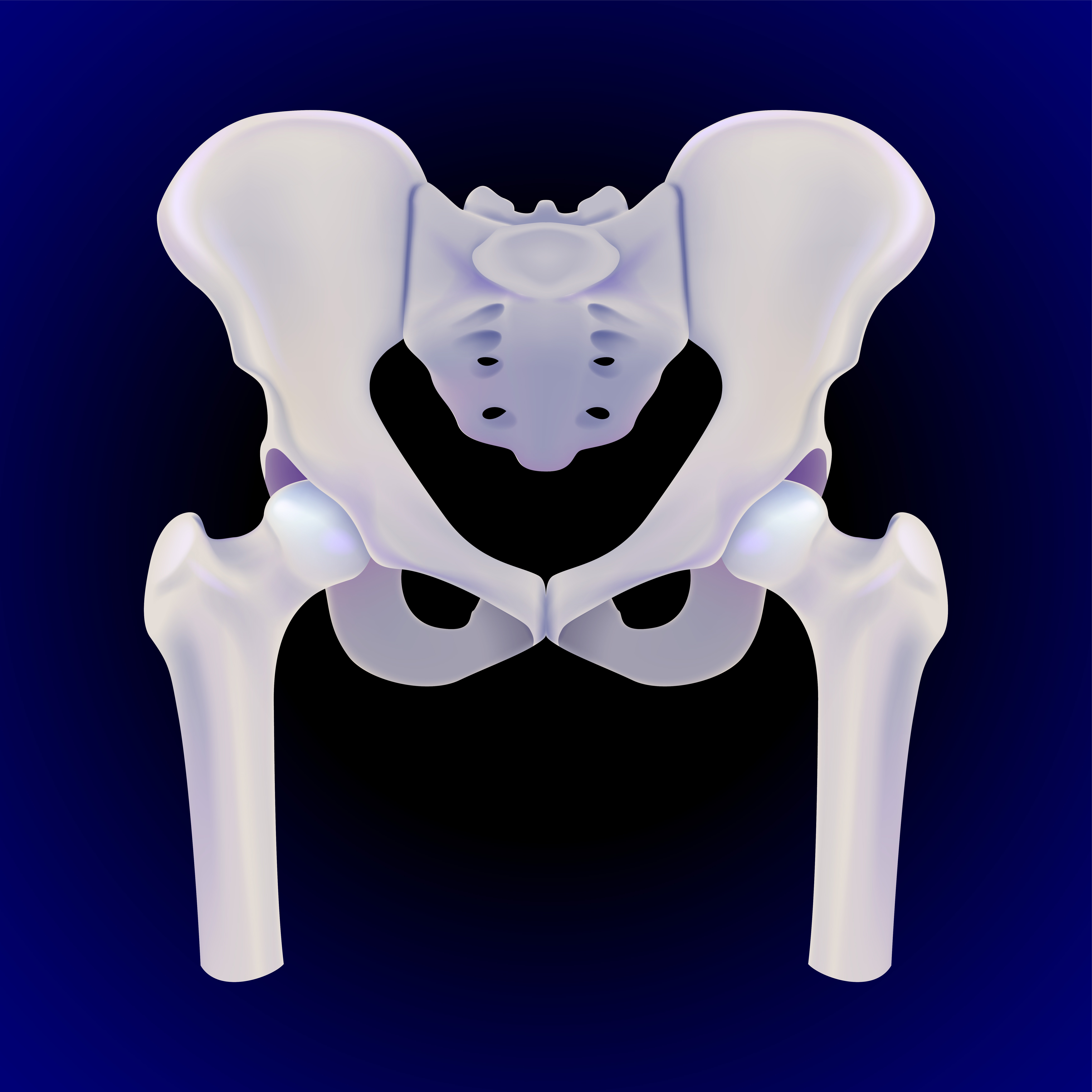 A computer-generated image presenting hip structure with a dark blue background. Hip replacement surgery involves replacing the ball and socket of a hip joint and replacing them with artificial components.